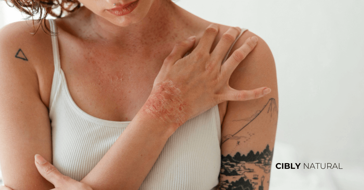 Атопична кожа с нарушена кожна бариера схема преди и след лечение