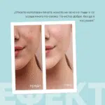 Почистваща пяна за лице – за мазна и смесена кожа с хиалурон и алое - Image 5