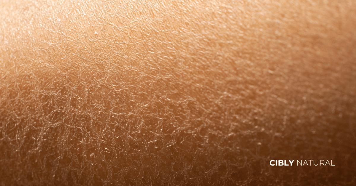 Сравнение на суха кожа с нарушена бариера и здрава кожа с интактна липидна бариера – визуализация на структурни разлики