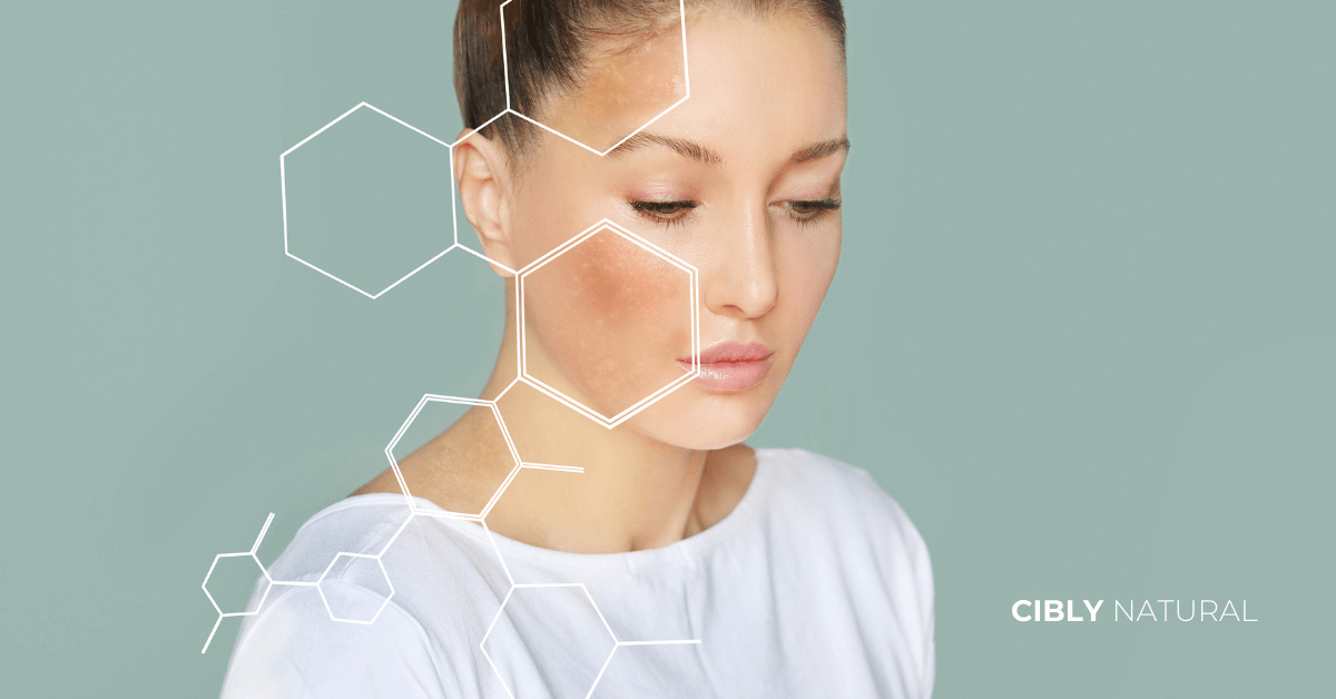 Смесена кожа характеристики – Т-зона с блясък и сухи бузи