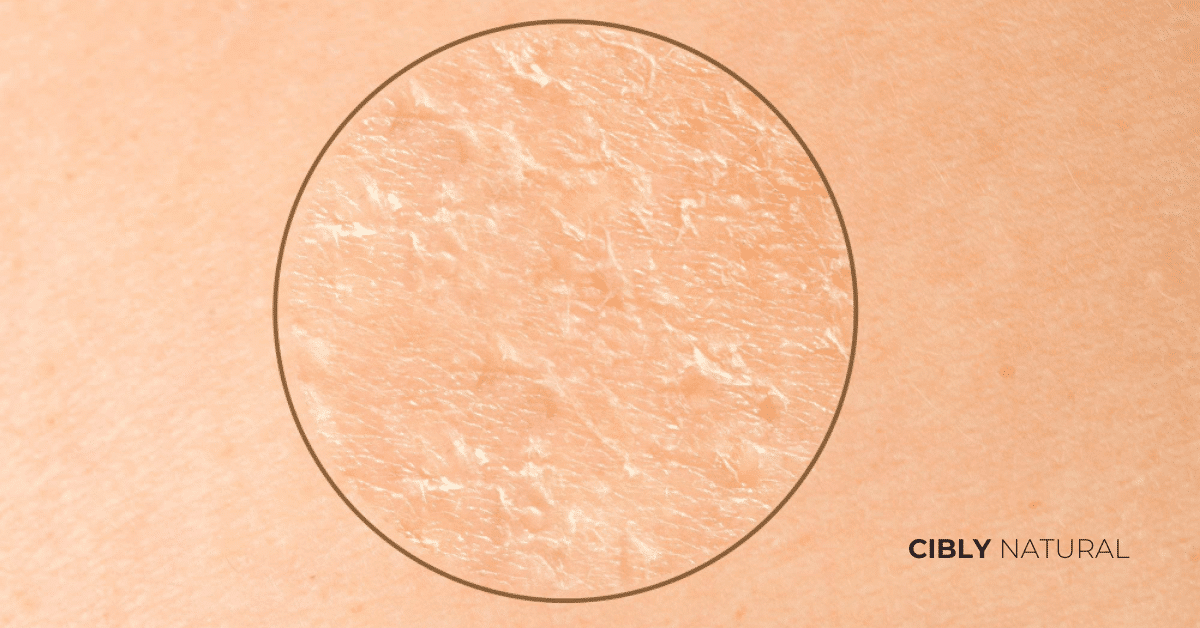 Структура на сухата кожа срещу хидратирана кожа – кутикула и липидна бариера