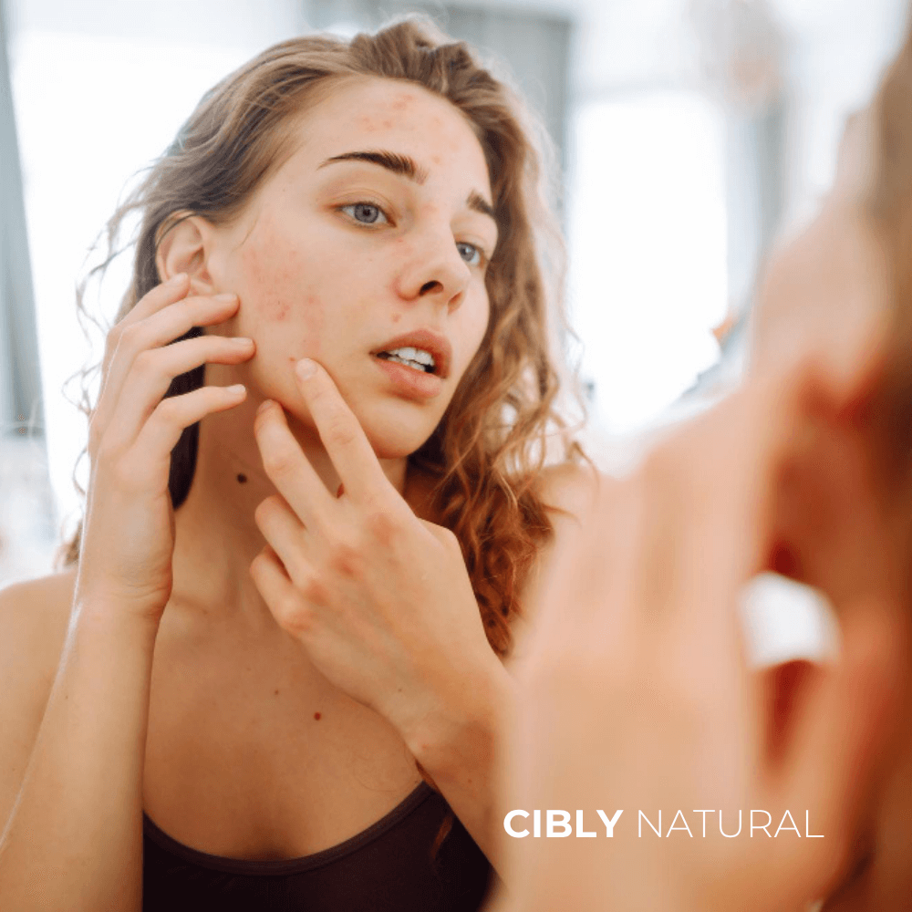 Жена разглежда белези от акне в огледалото - преди третиране с масло от безсмъртниче