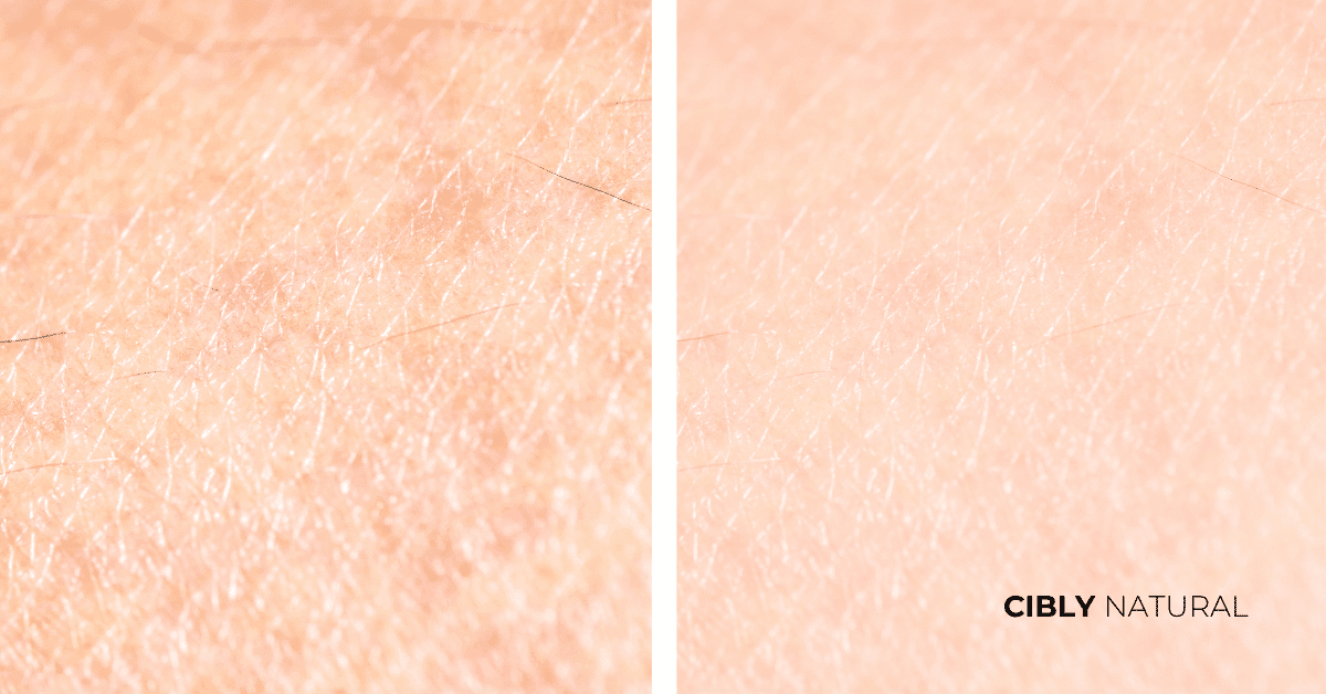 Преди и след употреба на глицерин – подобрена кожна бариера