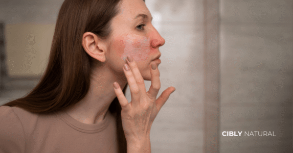 Увредена кожна бариера – визуализация на barrier damage и възстановяване