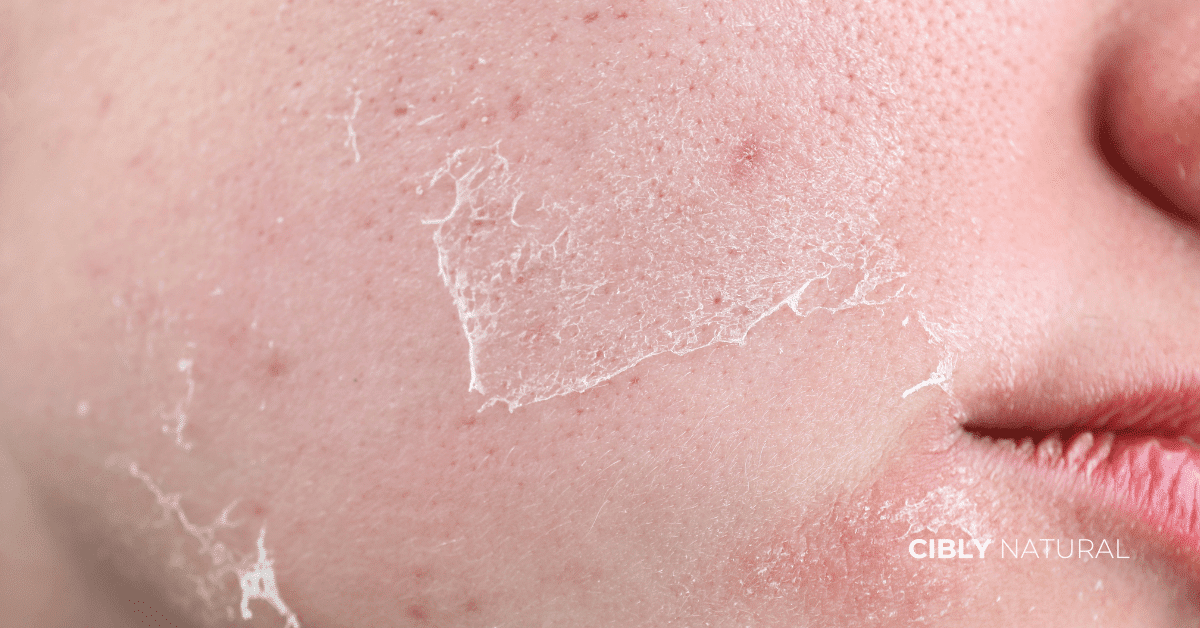 Схема на здрава vs увредена кожна бариера – корнеоцити и липиди