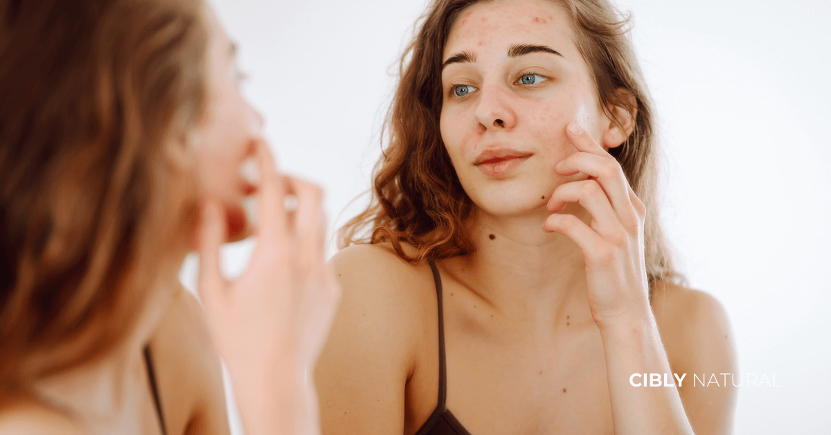 Сравнение между дехидратирана мазна кожа и балансирана хидратирана мазна кожа