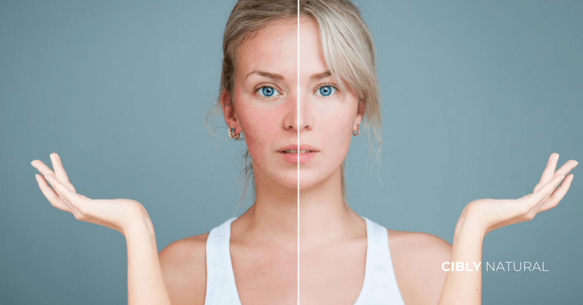 Преди и след дълбока хидратация – сравнение на кожа след 14 дни интензивна грижа