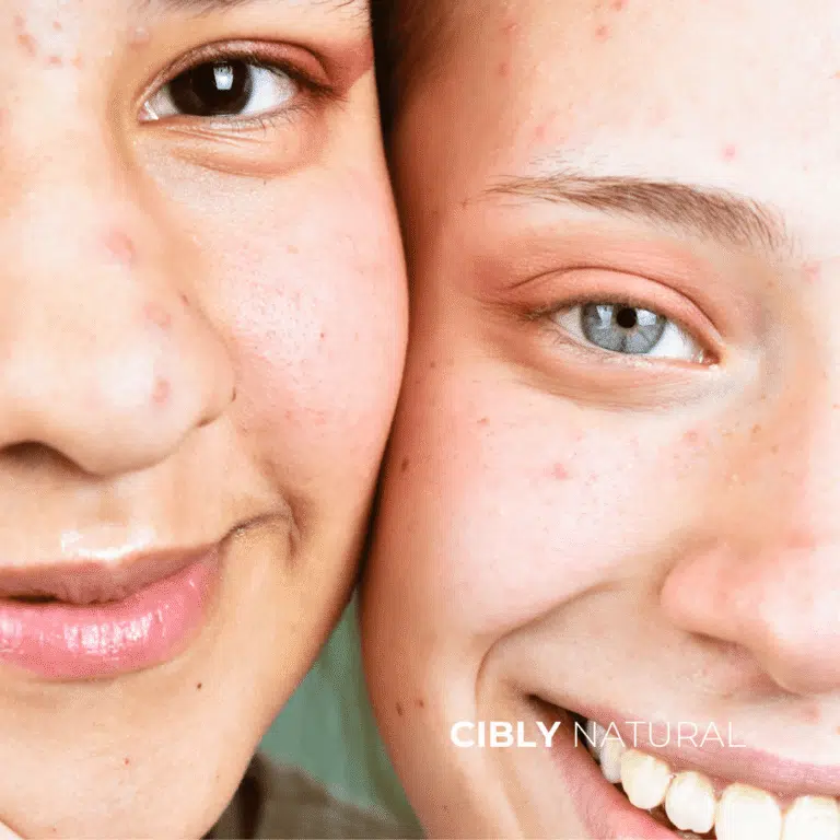 Запушени пори от комедогенни козметични съставки – сравнение с чиста кожа след некомедогенни продукти